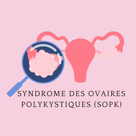 Comprendre le Syndrome des Ovaires Polykystiques (SOPK)