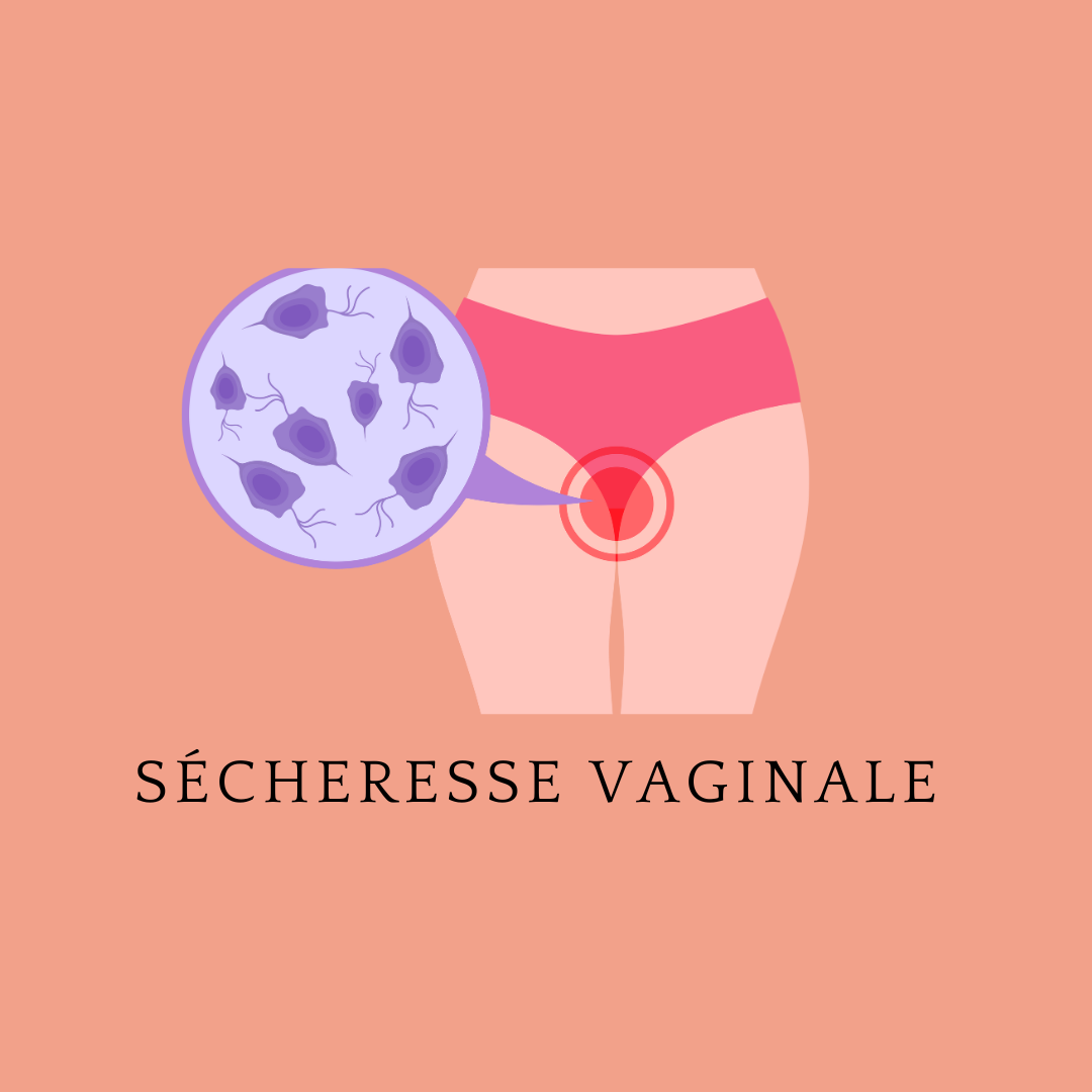 Comprendre et Gérer la Sécheresse Vaginale